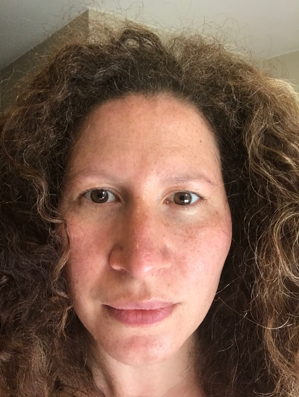 Battle with large pores:&nbsp;skincare